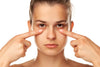 What Causes Dark Circles Under Eyes? Common Triggers Revealed